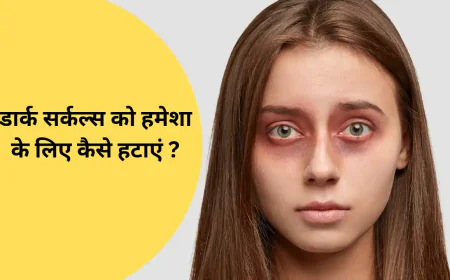 डार्क सर्कल्स को हमेशा के लिए कैसे हटाएं – बिना केमिकल के असरदार तरीका
