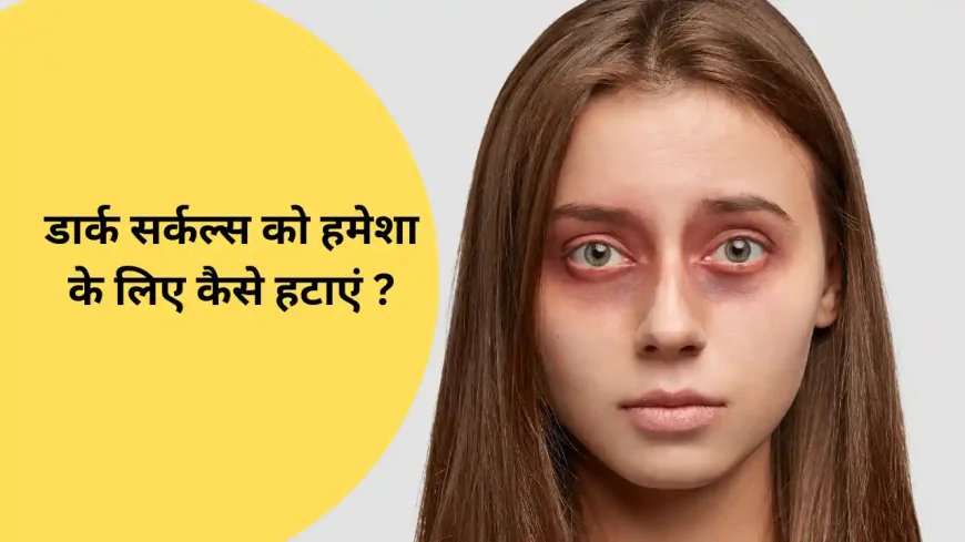 डार्क सर्कल्स को हमेशा के लिए कैसे हटाएं – बिना केमिकल के असरदार तरीका